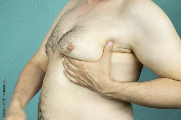How to Reduce Chest Fat in 10 Days For Male?